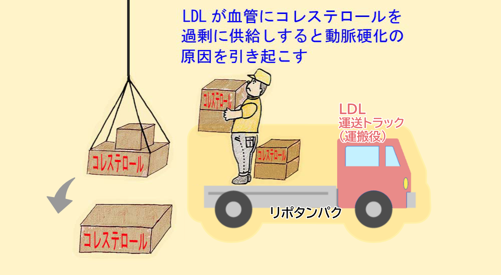 LDLとは