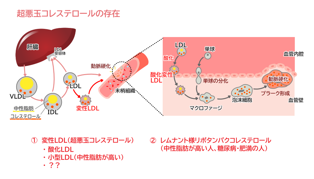 超悪玉コレステロールの存在