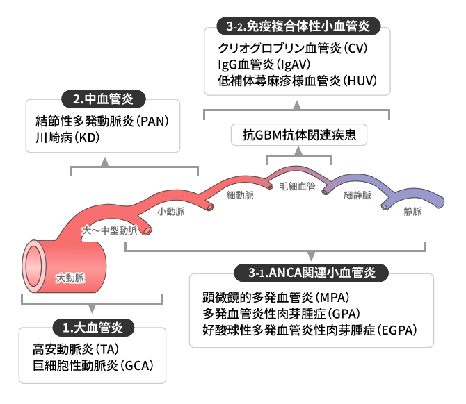 血管炎の分類