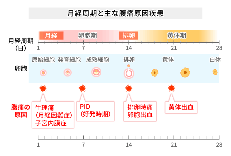 月経周期と主な腹痛原因疾患