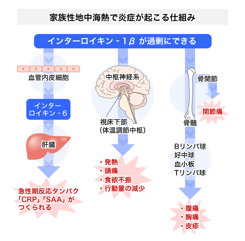 家族性地中海熱FMFで炎症が起こる仕組み