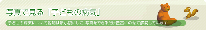 写真画像で見る「子どもの病気」子どもの病気について説明は最小限にして、写真をできるだけ豊富にのせて解説しています。